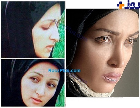 عکسی از بازیگر زن قبل و بعد از عمل زیبایی!